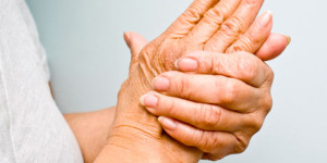 Arthritis