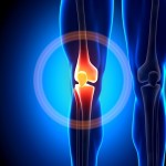 knee-pain-ca